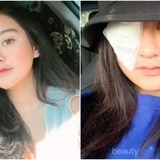 Belajar dari Salshabilla Adriani, Ini Tips Aman Menggunakan Softlens Ladies!