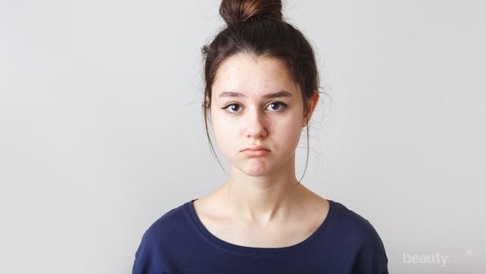 Ini Dia Rekomendasi 5 Skincare Lokal Buat Kamu yang Berjerawat!