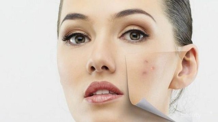 Cara Alami Basmi Bekas Jerawat