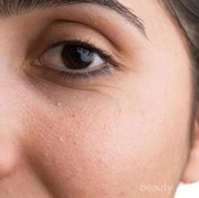 [FORUM] Cara menghilangkan beruntusan akibat makeup gimana sih...