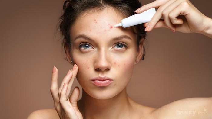 Acne Porne! Ini 5 Rekomendasi Serum untuk Menghilangkan Jerawat
