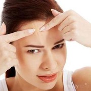 Jerawat Batu Muncul di Jidat? Segera Atasi dengan Cara Ampuh dan Aman ini!