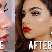 Ampuh, 8 Concealer Terbaik Ini Mampu Tutupi Bekas Jerawat dengan Sempurna