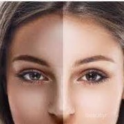 [FORUM] Gimana cara menghilangkan belang di wajah?