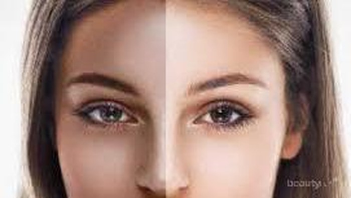 [FORUM] Gimana cara menghilangkan belang di wajah?