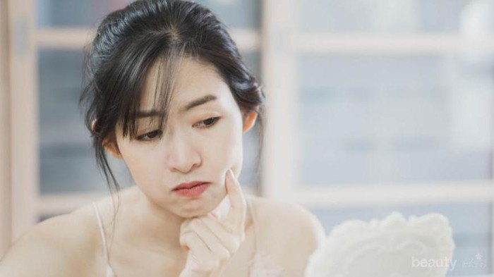 Tidak Susah, Begini Cara Menghilangkan Jerawat Batu