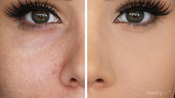 Produk Skincare Lokal untuk Atasi Pori-pori Besar Produk Skincare Lokal untuk Atasi Pori-pori Besar