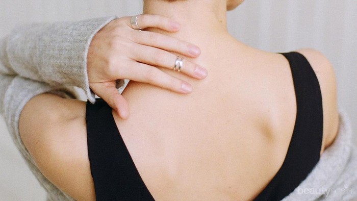 Muncul Jerawat Muncul di Punggung? Kenali 5 Penyebabnya Berikut Ini!