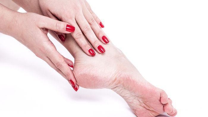 Permasalahan Tumit Kaki Jadi Mimpi Buruk? Atasi dengan 6 Bahan Alami ini!