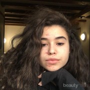 Tips Skincare: Mana yang Lebih Baik untuk Wajah, Centella Asiatica atau Niacinamide?