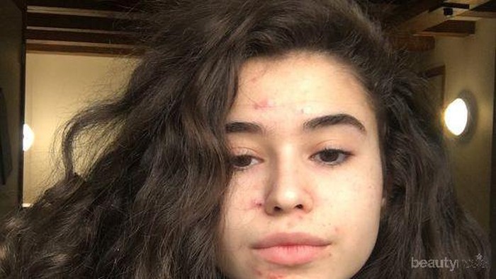 Tips Skincare: Mana yang Lebih Baik untuk Wajah, Centella Asiatica atau Niacinamide?