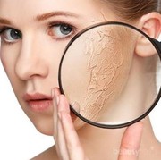 [FORUM] Solusi buat kulit kering! Cek disini yuk!