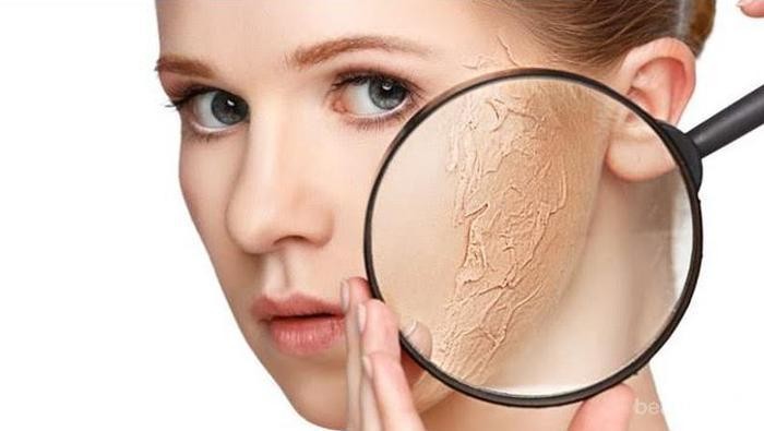 [FORUM] Solusi buat kulit kering! Cek disini yuk!