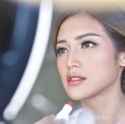 Cerita Jessica Iskandar dengan Wajah Bercak Merah Setelah Anestesi, Kok Bisa?