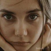 [FORUM] Gimana cara nyembuhin acne yang bertahun-tahun ga bisa sembuh?