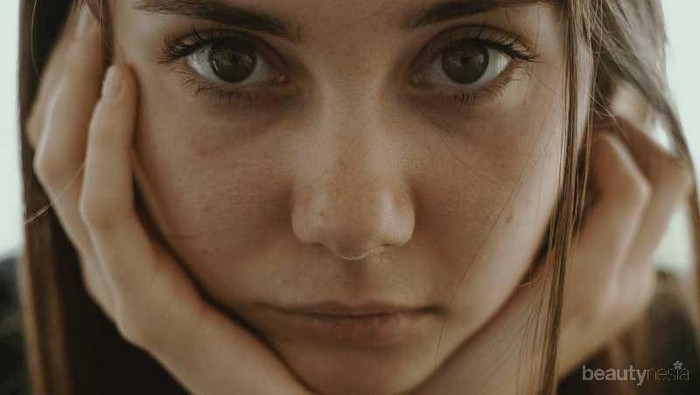 [FORUM] Gimana cara nyembuhin acne yang bertahun-tahun ga bisa sembuh?