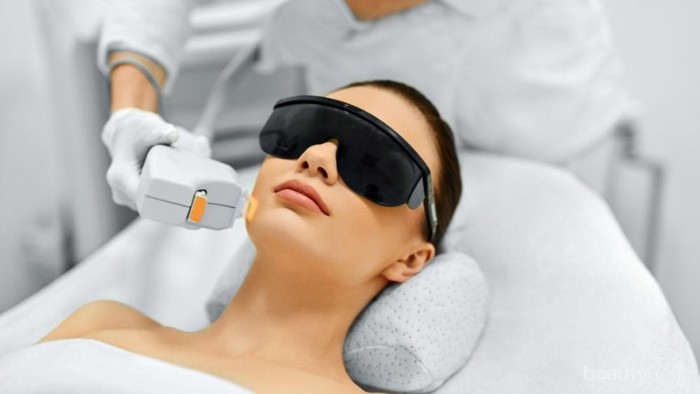 Sebelum Laser Wajah, Cari Tahu Dulu Jenis-jenisnya untuk Menghilangkan Bekas Jerawat