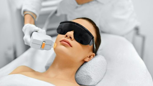 Sebelum Laser Wajah, Cari Tahu Dulu Jenis-jenisnya untuk Menghilangkan