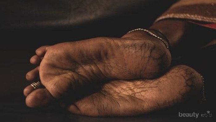 Wajib Ketahui! 5 Foot Cream Ampuh Atasi Tumit Kaki yang Pecah-pecah Wajib Ketahui! 5 Foot Cream Ampuh Atasi Tumit Kaki yang Pecah-pecah