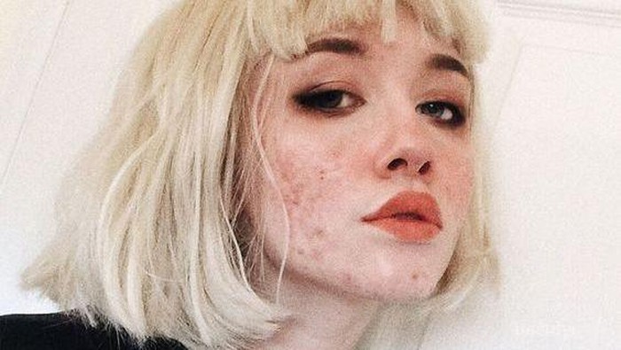 Ampuh Atasi Jerawat, Coba Facial Wash dengan Kandungan Tea Tree Ini