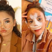 Cerita Rachel Goddard Operasi Hidung karena Flu Tak Kunjung Sembuh