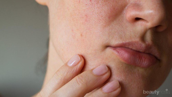 [FORUM] Ada yang pernah alergi protein?