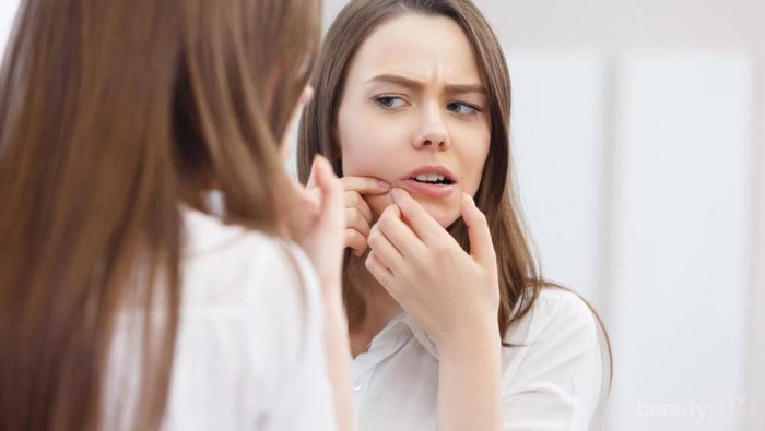 Gak Disangka, 5 Hal Sepele Ini Bisa Bikin Wajah Kamu Jerawatan!