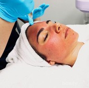 Skincare 101: Vampire Facial, Perawatan Wajah dengan Darah, Apakah Efektif?