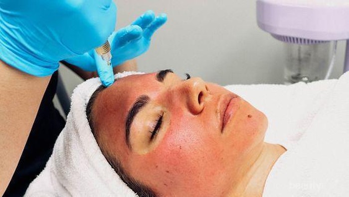 Skincare 101: Vampire Facial, Perawatan Wajah dengan Darah, Apakah Efektif?