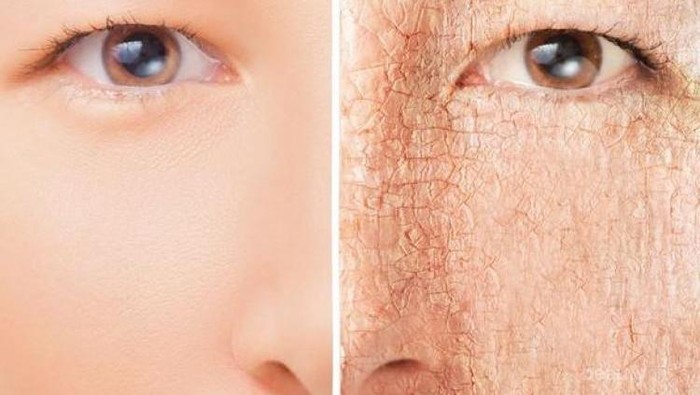 [FORUM] Share dong ladies, gimana sih cara ngatasin kulit kering karna kurang minum?