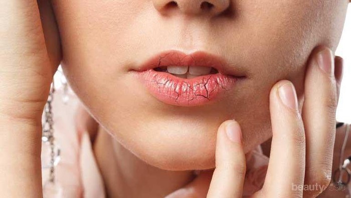 Bibir Pecah-pecah Tak Kunjung Reda, Mungkin Kamu Belum Lakukan 5 Hal Ini