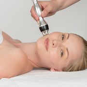 4  Perawatan Medis yang Bikin Wajah Terlihat Tirus, Bye-bye Pipi Chubby!