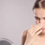 Kulit Mengelupas di Area Hidung? Atasi dengan Cara Ini!