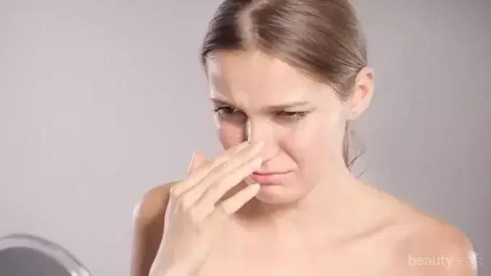 Kulit Mengelupas di Area Hidung? Atasi dengan Cara Ini!