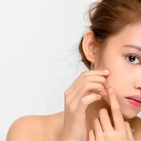 5 Cara Menghilangkan Bruntusan di Wajah Bagi Remaja, Kulit Kembali Mulus!
