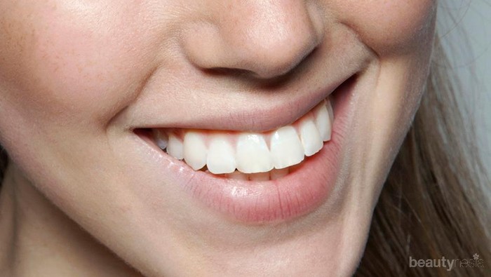 Menurut Dokter Gigi, Ini 4 Cara Paling Efektif Putihkan Gigi