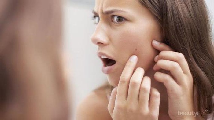 Terbukti Ampuh, Rekomendasi Cream Penghilang Bekas Jerawat yang Dijual di Apotek