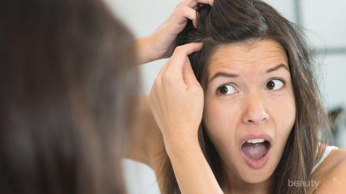 Kamu Punya Masalah Kutu Rambut? Yuk Segara Hilangkan dengan Cara Ini