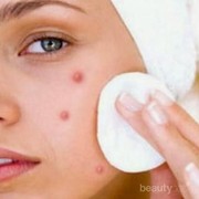 Kulit Wajah Berjerawat dan Kusam Bikin Gak Pede? Yuk Cek Solusinya, Ladies!