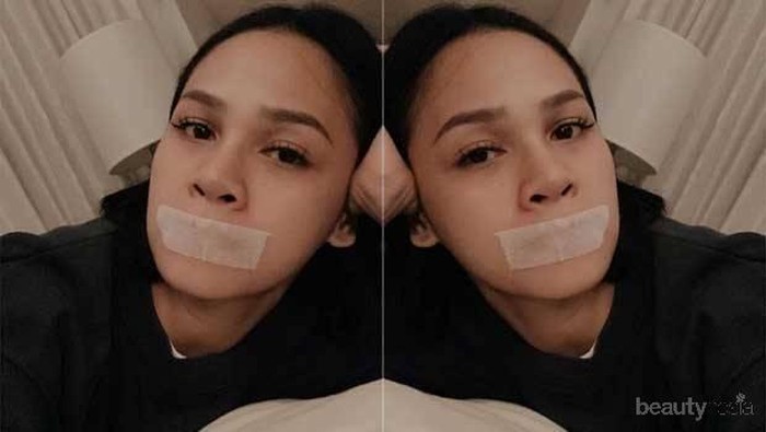 Tren Buteyko, Menutup Mulut Saat Tidur dengan Plester yang Dilakukan Andien, Apa Bahayanya?