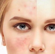 [FORUM] Masalah Wajah