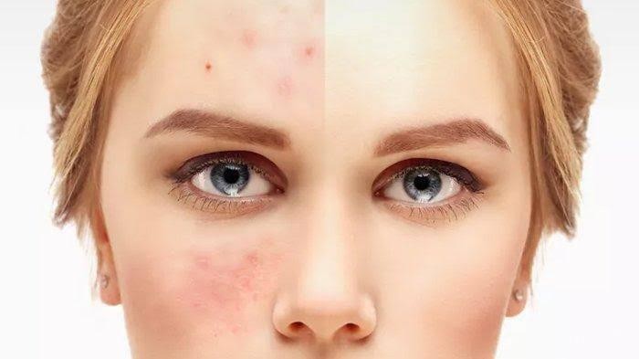 [FORUM] Masalah Wajah