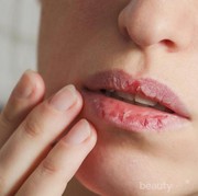 Bibir Kamu Kering? 5 Hal ini Mungkin Penyebabnya Ladies!
