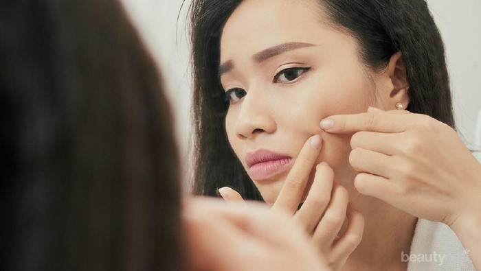 Sariayu Acne Care, Rangkaian Produk Lokal untuk Tuntaskan Jerawat Bandel