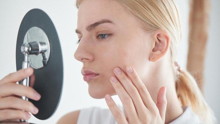 Trik Menutupi Jerawat Menyebalkan dengan Concealer, Beda Jenis Caranya pun Tak Sama