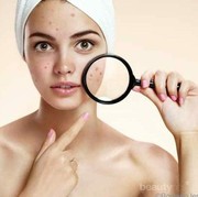 5 Produk Skincare Ini Ampuh untuk Menghilangkan Flek Hitam Pada Wajah, Ladies! Kamu Wajib Coba