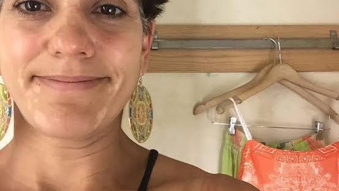 [FORUM] Pipi memutih seperti kehilangan pigmen karna produk AHA BHA