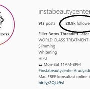[FORUM] Melakukan Perawatan Filler dan Tanam Benang Hidung di Insta Beauty Center