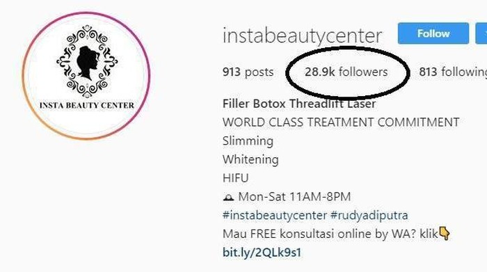 [FORUM] Melakukan Perawatan Filler dan Tanam Benang Hidung di Insta Beauty Center