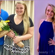 Viral, Wanita Ini Sukses Turunkan Berat Badan Sampai 36 Kilogram dengan Diet Keto!